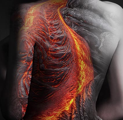 a person's back which lava like illustration refering to eczema