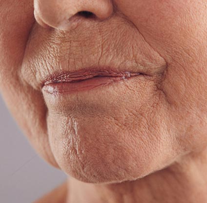 wrinkled mouth of an aged woman
